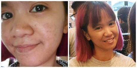 Bye Dark Spots: Some By Mi Galactomyces Pure Vitamin C Glow Toner Review