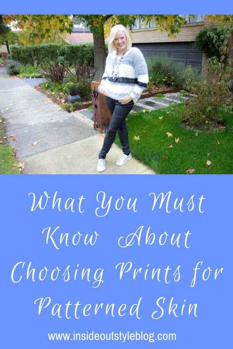 What You Must Know  About Choosing Prints for Patterned Skin