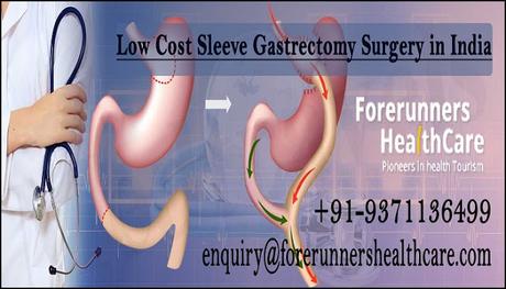 Sleeve Gastrectomy Surgery in India – Save Money While Staying Safe