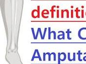 Amputation Definition: What Causes Amputation?