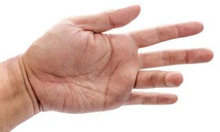 Reasons For Trigger Finger By Physiotherapists in Kolkata