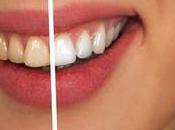 Natural Tips Teeth Whitening
