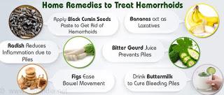 hemorrhoids natural remedy 