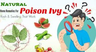 Home Remedies for Poison ivy