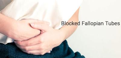 Find Out The Causes Of Blocked Fallopian Tubes & Its Various Sorts