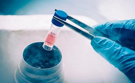 Does storing stem cells really help?