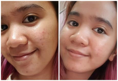 WTF is Tiger Grass & Why is It Good For Our Skin? WTF is Tiger Grass & Why is It Good For Our Skin?