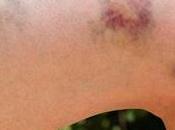 Care Pack Ayurvedic Combination Treatment