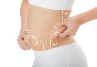 Liposuction - How Effective It Is?