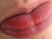 Reasons Your Tongue Swell Require Medical Attention