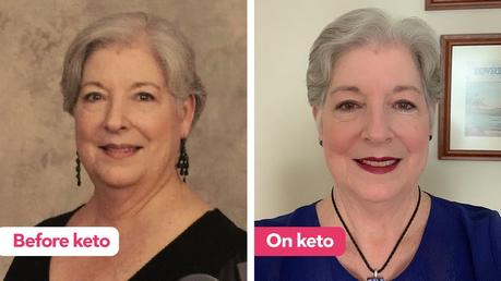 “To say keto has changed my life is an understatement” “To say keto has changed my life is an understatement”