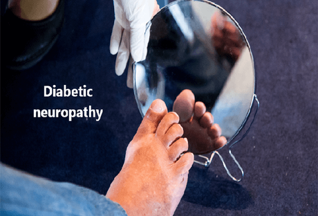 10 Natural Remedies for Diabetic Neuropathy