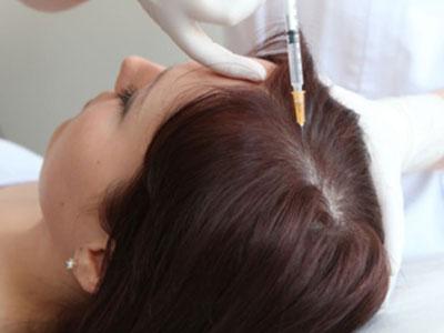 Is Mesotherapy Effective For Hair Loss?