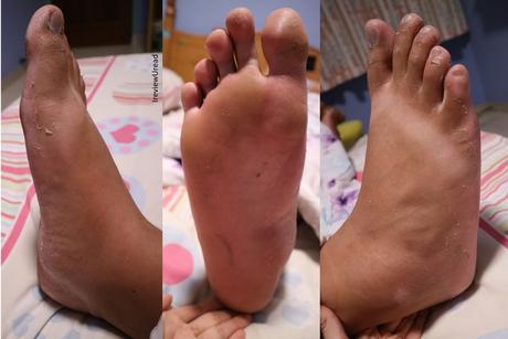 Get your feet as soft as a baby’s bottom | Lazy Monk Foot Peel Mask Review