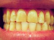 Whiten Your Teeth With Ayurveda?