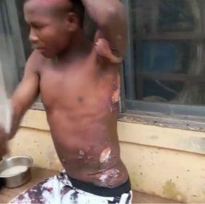 Wickedness! Mother Pours Hot Water On Her Son While Sleeping – Photos
