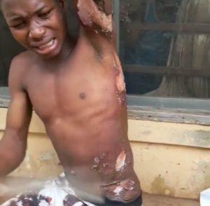 Wickedness! Mother Pours Hot Water On Her Son While Sleeping – Photos