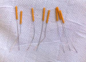 Bent acupuncture needles