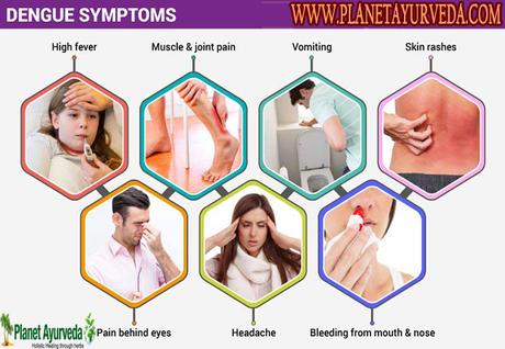 Alternative Treatments and Diets For Dengue Patients Alternative Treatments and Diets For Dengue Patients