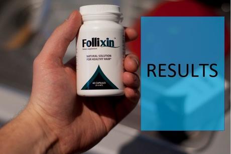 Follixin Review: See Its Results, Benefits, Side Effects