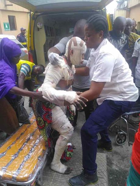Two Dead, 23 Others Severely Burnt In Lagos Gas Explosion (Graphic Photos)