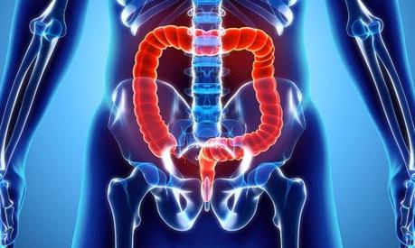 What are the symptoms, causes, diagnosis and best alternative treatment for Pancolitis?