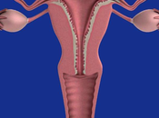 Treatment Ovarian Cysts Ayurveda