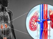 Primary Hyperaldosteronism (Conn’s Syndrome) Treatment Ayurveda