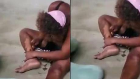 Watch As This Lady Peels Her Skin With Blade Just To Have A ‘Fair Skin’ [Video]