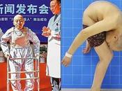 Medical Condition Makes Spend Years Life With Head Stuck Knees (Photos)