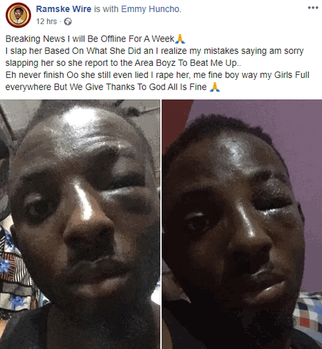 Girlfriend Mobilize Area Boys To Beat Up Boyfriend Who Mistakenly Slapped Her [Photos]