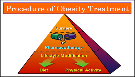 Low Cost  Obesity Surgery in India in the Best Bariatric Centers