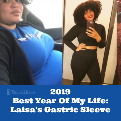 Best Year Of My Life: Laisa’s Gastric Sleeve