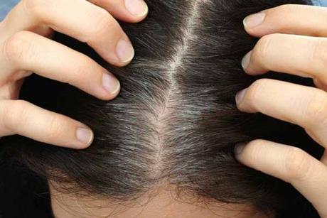 Home Remedies To Prevent Grey Hair Try Various Home Remedies That Can Help Prevent Grey Hair
