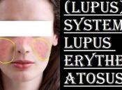 SLE(Lupus): Systemic Lupus Erythematosus