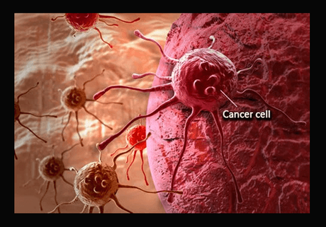 Can a Positive Mindset Beat Cancer? Can a Positive Mindset Beat Cancer?