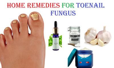 Home remedies for Toenail fungus