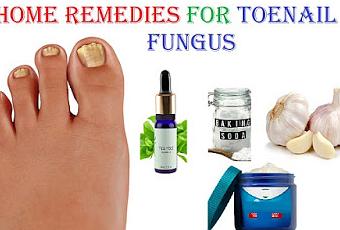 What Are Best Home Remedies for Toenail Fungus - Paperblog