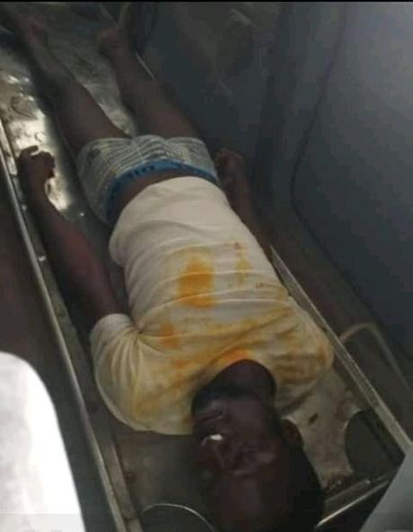 UniCal student commits suicide by drinking sniper [Graphic Photo]