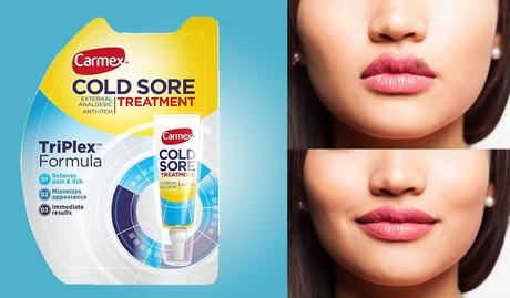 Cold Sore Treatment And Products