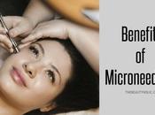 Surprising Benefits Microneedling Skin