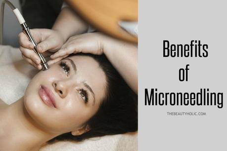 11 Surprising Benefits of Microneedling for the Skin