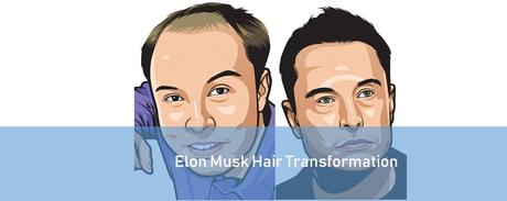 Elon Musk Hair Loss and Recovery Story [Transformation] - Paperblog