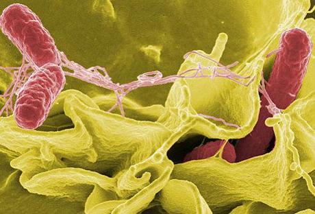 Salmonella bacteria: image via webmd.com