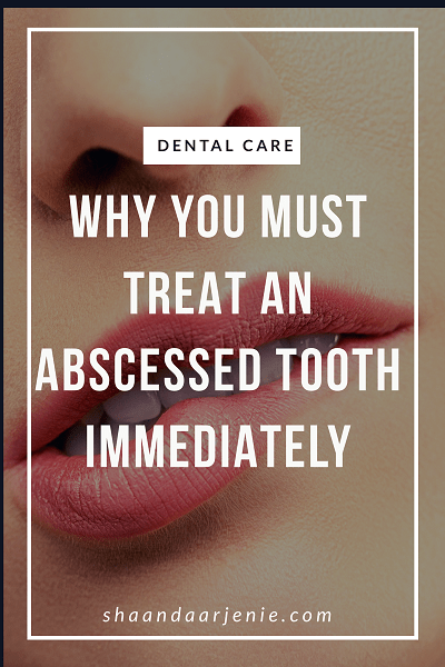 Why You Must Treat An Abscessed Tooth Immediately