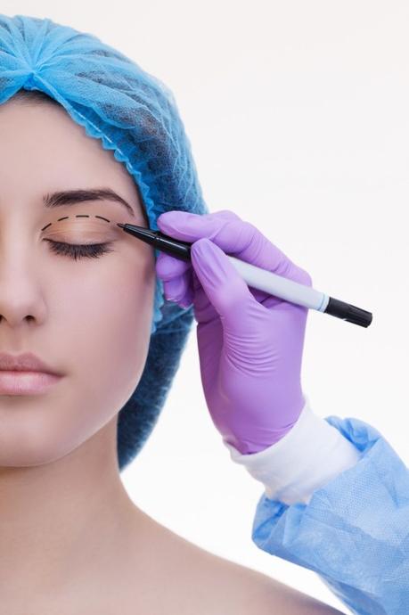 What You Should Know About Blepharoplasty in Singapore