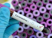 Coronavirus (covid -19)