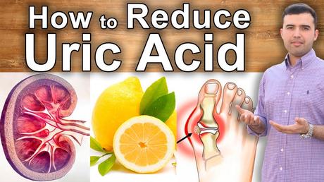 How to Reduce Uric Acid Naturally?