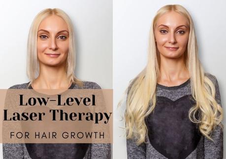 Low-Level Laser Therapy for Hair Growth : Things You Should Know