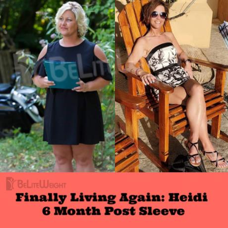 Finally Living Again: Heidi 6 Month Post Sleeve